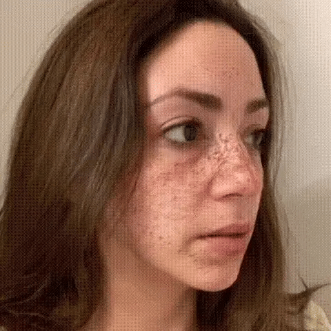 【Dermatologist-Recommended】 VC Spot-Correction & Whitening Cream Set