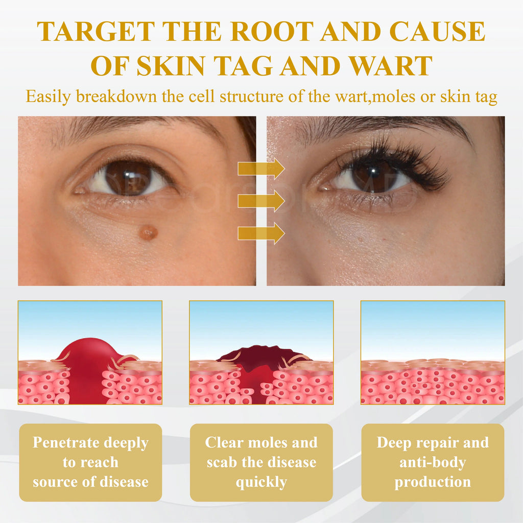 【Dermatologist-Recommended】 VC Spot-Correction & Whitening Cream Set