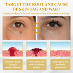 【Dermatologist-Recommended】 VC Spot-Correction & Whitening Cream Set