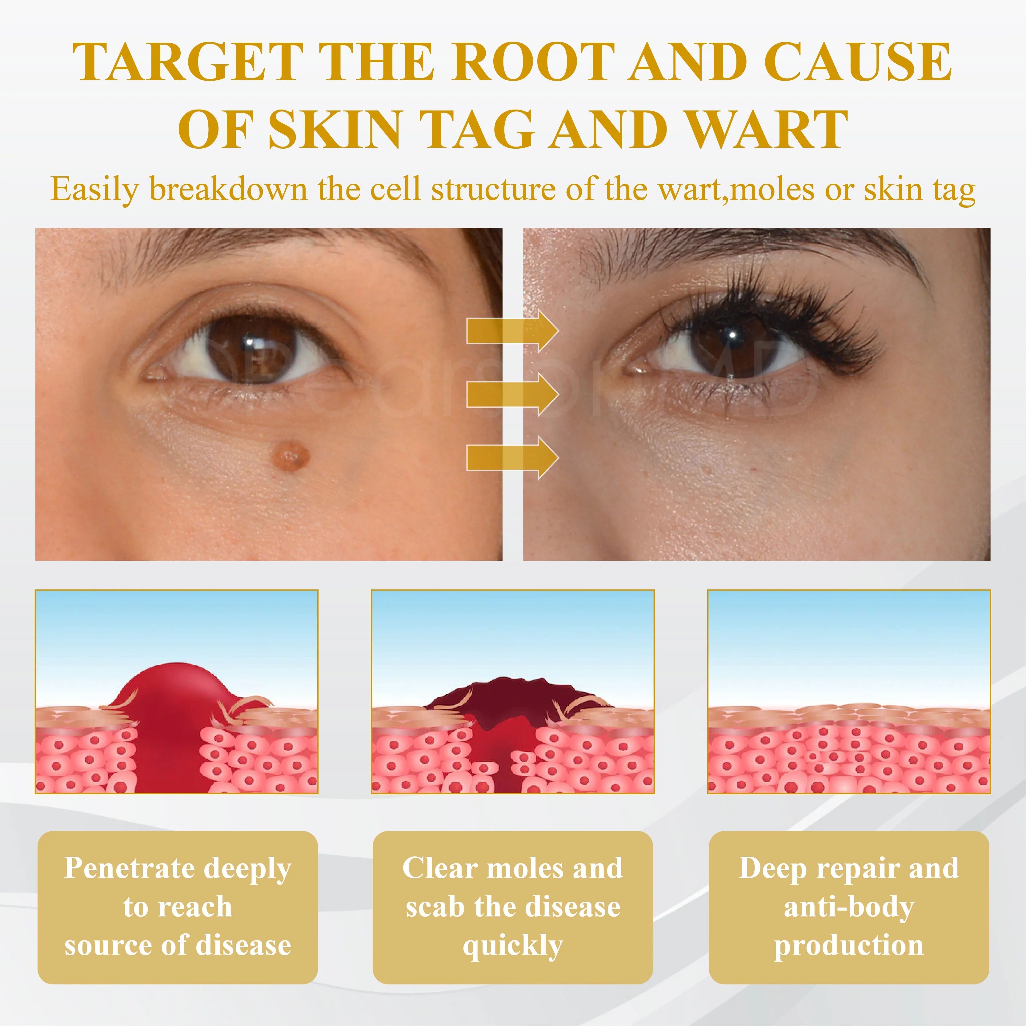 【Dermatologist-Recommended】 VC Spot-Correction & Whitening Cream Set