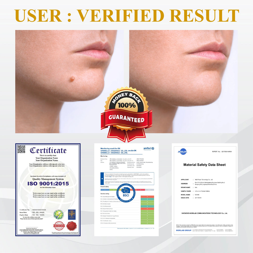 【Dermatologist-Recommended】 VC Spot-Correction & Whitening Cream Set