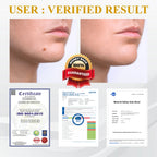 【Dermatologist-Recommended】 VC Spot-Correction & Whitening Cream Set