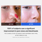 Mirco Pore Pads (AHA + BHA) |Acne-prone skin care