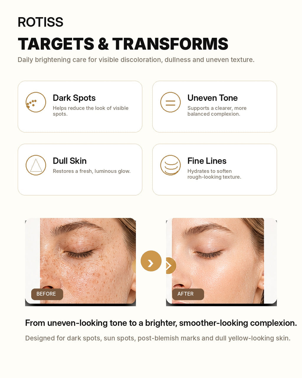ROTISS Whitening Spot Removal Set – Dark Spot & Brightening Skincare