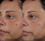 5-Step Advanced Clinical Anti-Spot All-Round Set